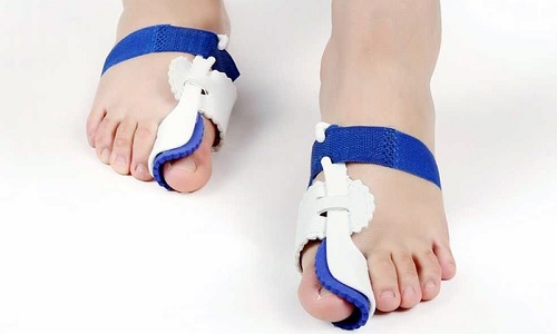 Orthopaedic Foot Bunion Correctors